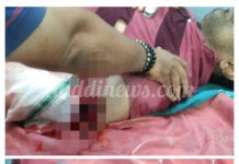 ವಾಕಿಂಗ್ ಹೋಗುತ್ತಿದ್ದ ವೇಳೆ ಅಪರಿಚಿತ ವಾಹನ ಡಿಕ್ಕಿ: ಗಂಭೀರ ಗಾಯ